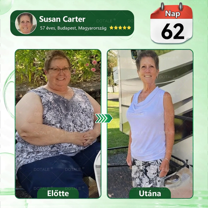 🎉 Gratulálunk! A jelenlegi rendeléséhez most egy különleges ajánlatot vehet igénybe, és ezt a terméket 50% kedvezménnyel adhatja hozzá. ✨