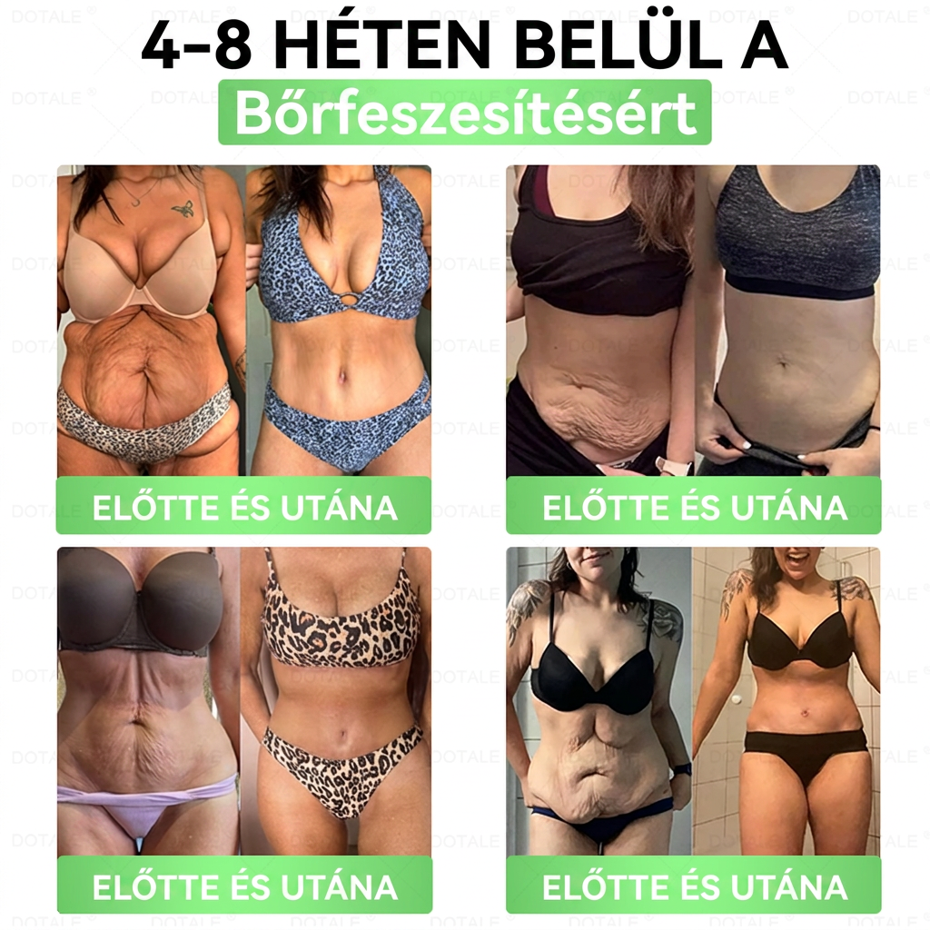 🎉 Gratulálunk! A jelenlegi rendeléséhez most egy különleges ajánlatot vehet igénybe, és ezt a terméket 50% kedvezménnyel adhatja hozzá. ✨