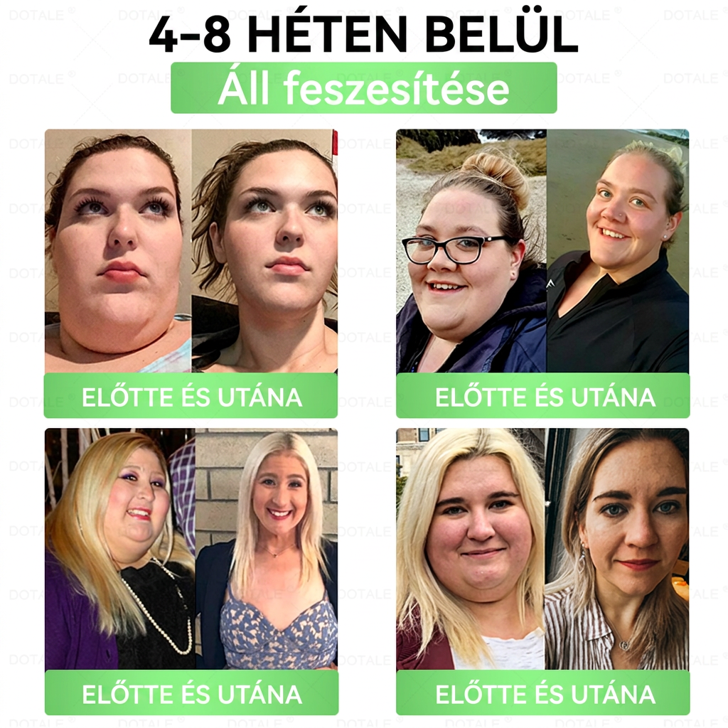 🎉 Gratulálunk! A jelenlegi rendeléséhez most egy különleges ajánlatot vehet igénybe, és ezt a terméket 50% kedvezménnyel adhatja hozzá. ✨