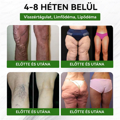🎉 Gratulálunk! A jelenlegi rendeléséhez most egy különleges ajánlatot vehet igénybe, és ezt a terméket 50% kedvezménnyel adhatja hozzá. ✨